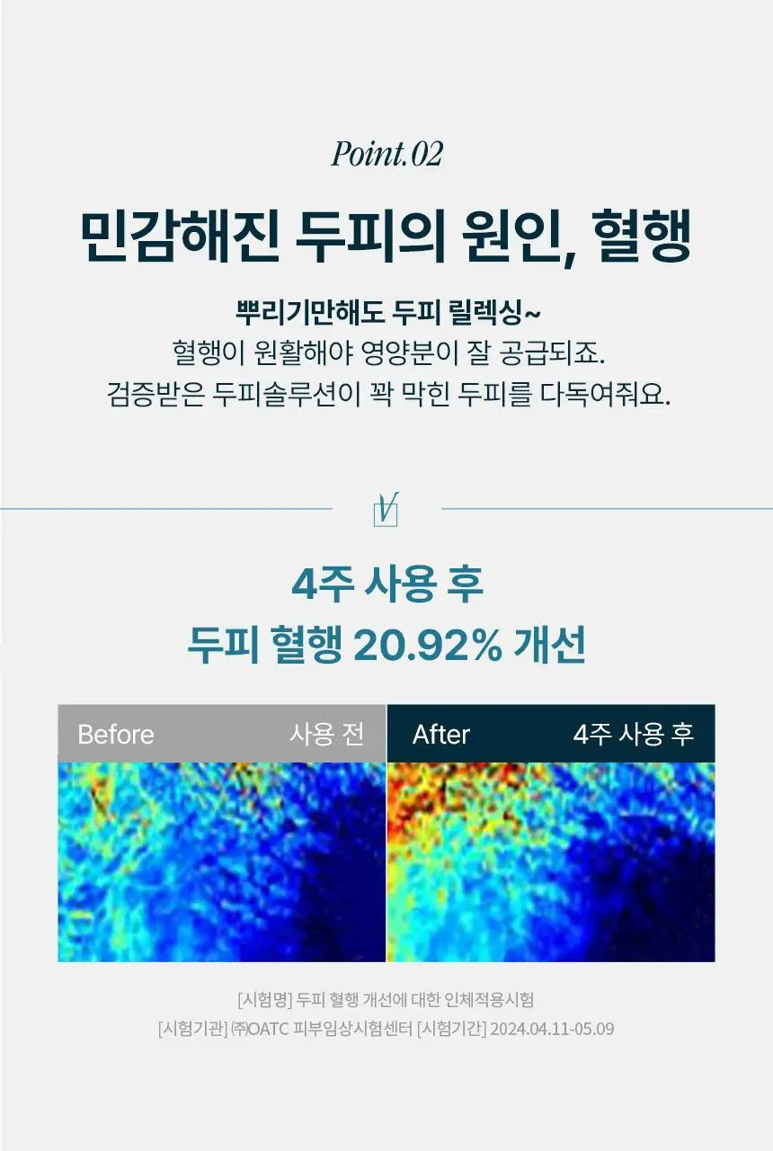 [탈모 전문가 토닉] 솔랩 탈모/민감두피 진정 미스트 토닉 100ml 상세페이지 17